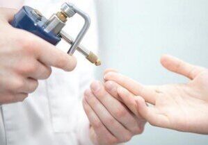 modern módszerek a papillómák eltávolítására