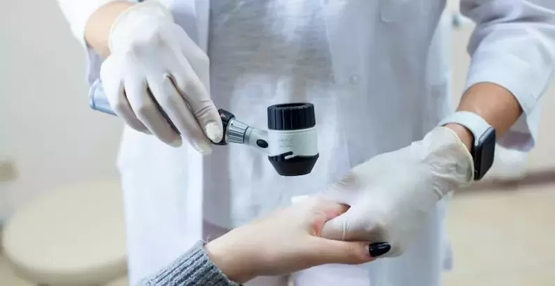 Szemölcsös beteg bőrgyógyász által végzett diagnosztikai vizsgálaton esik át